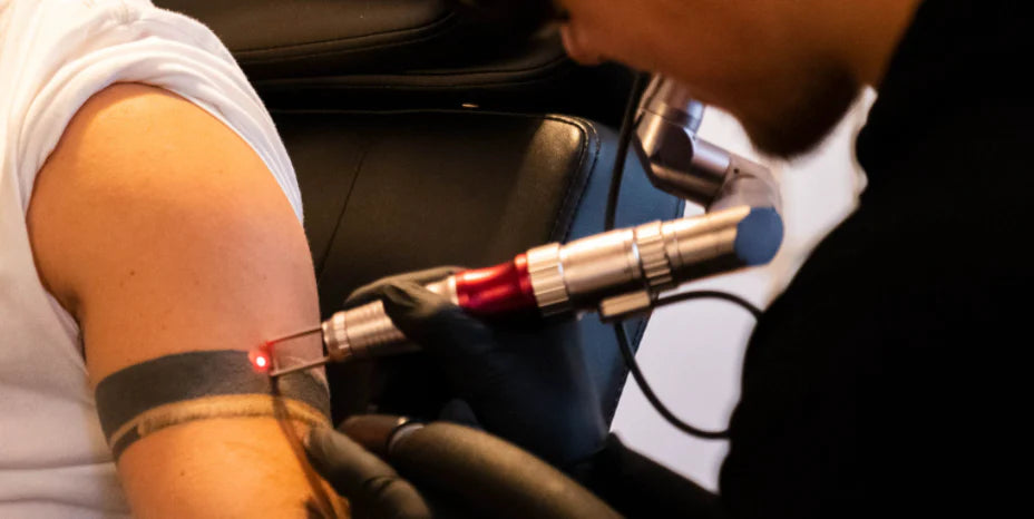 Laser Tattoo Removal Aftercare: Improve Recovery Time - Sorry Mom